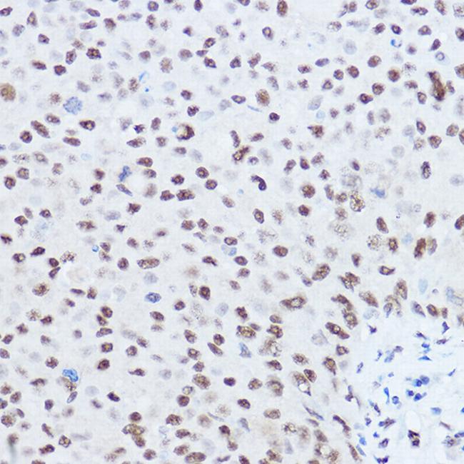 SKIV2L2 Antibody in Immunohistochemistry (Paraffin) (IHC (P))