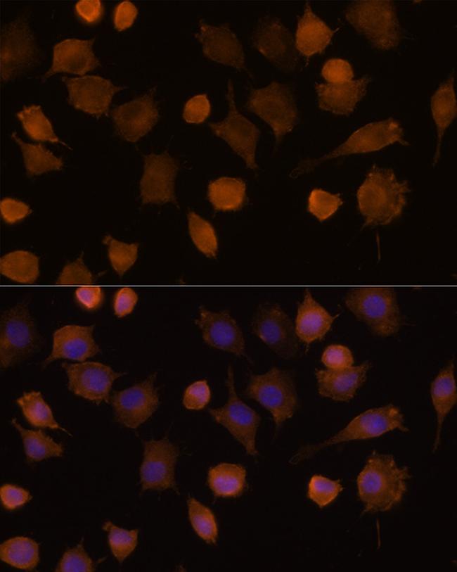 ICAM-1 Antibody in Immunocytochemistry (ICC/IF)