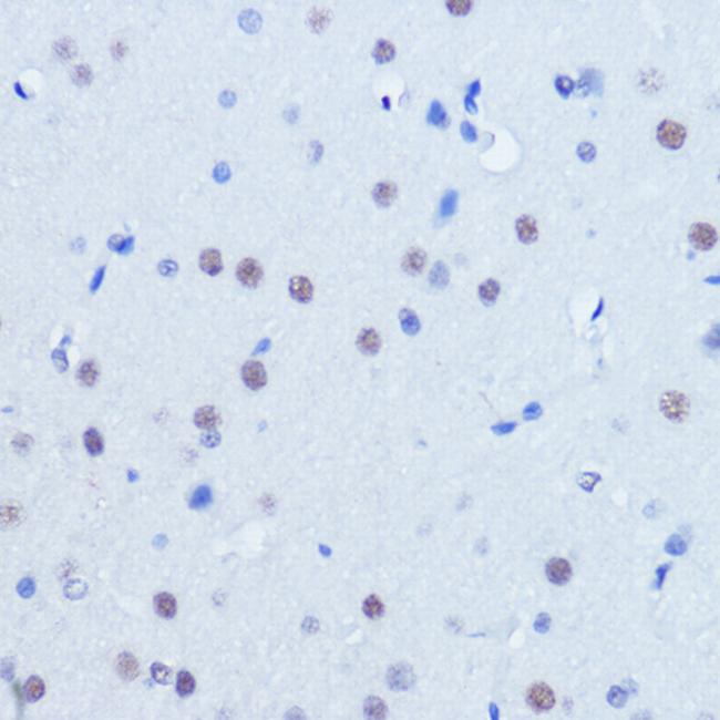 PIAS2 Antibody in Immunohistochemistry (Paraffin) (IHC (P))