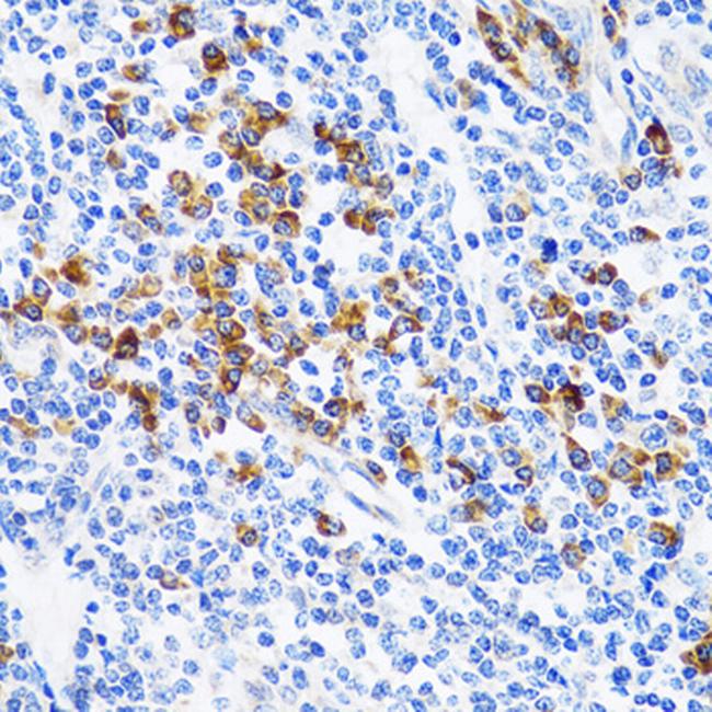 TWEAK Antibody in Immunohistochemistry (Paraffin) (IHC (P))