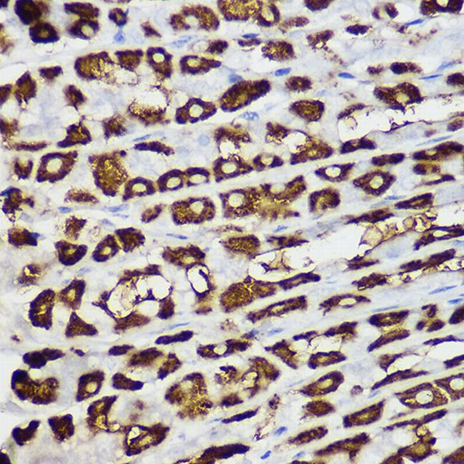 BNIP3 Antibody in Immunohistochemistry (Paraffin) (IHC (P))