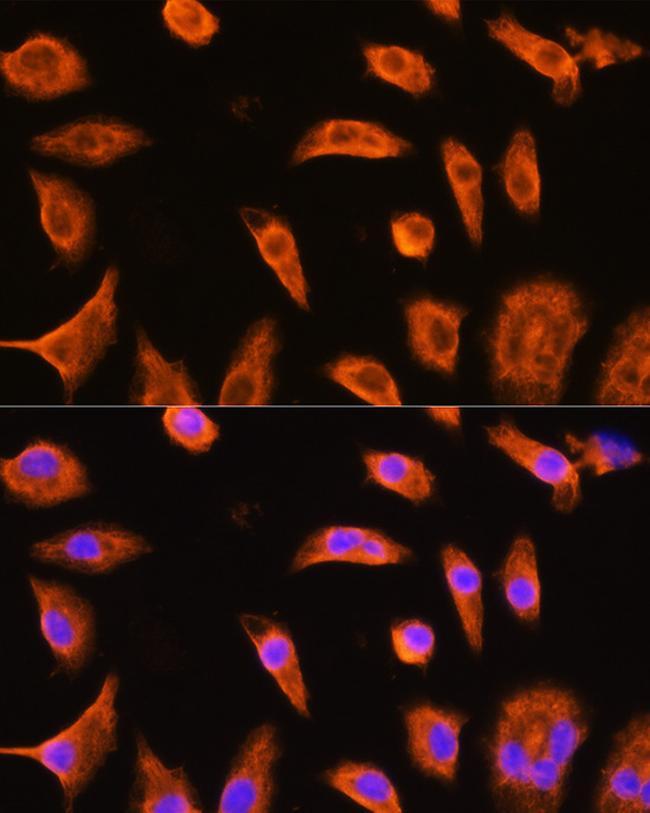 GSTP1 Antibody in Immunocytochemistry (ICC/IF)