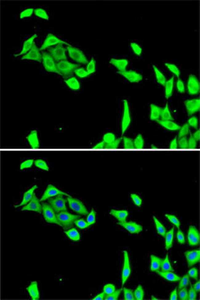 CDK5 Antibody in Immunocytochemistry (ICC/IF)