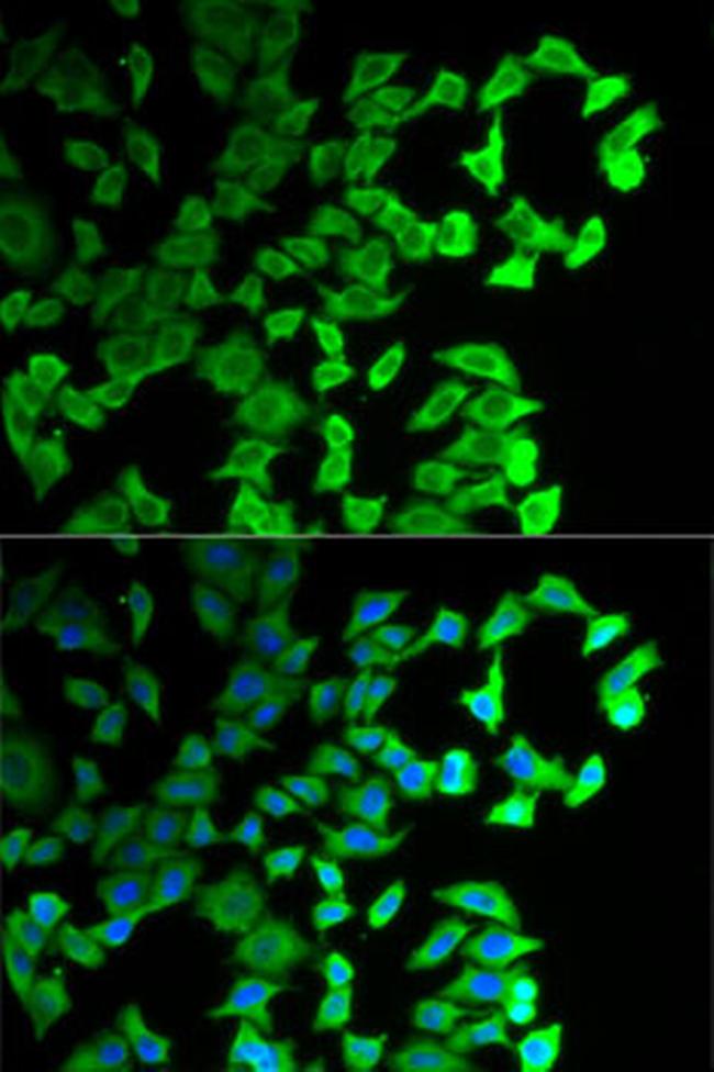 DIAPH1 Antibody in Immunocytochemistry (ICC/IF)