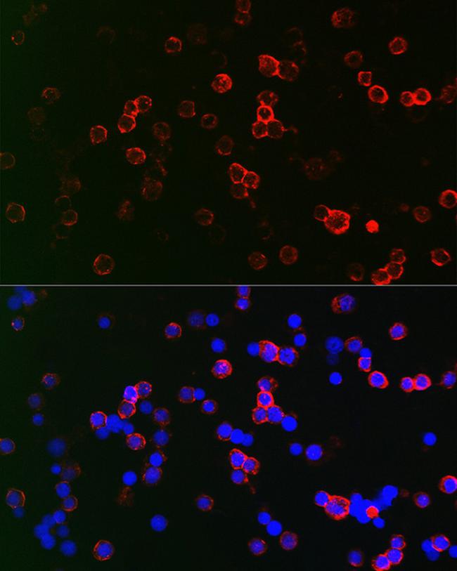 CD22 Antibody in Immunocytochemistry (ICC/IF)