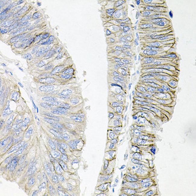 ATP1B1 Antibody in Immunohistochemistry (Paraffin) (IHC (P))