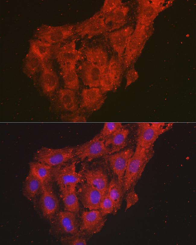 CXCL1 Antibody in Immunocytochemistry (ICC/IF)