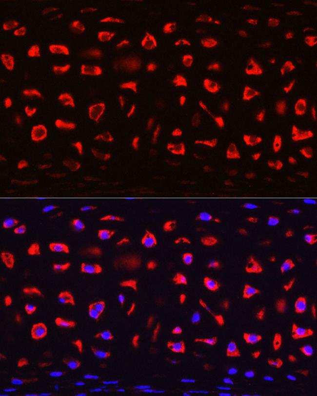 COMP Antibody in Immunohistochemistry (Paraffin) (IHC (P))