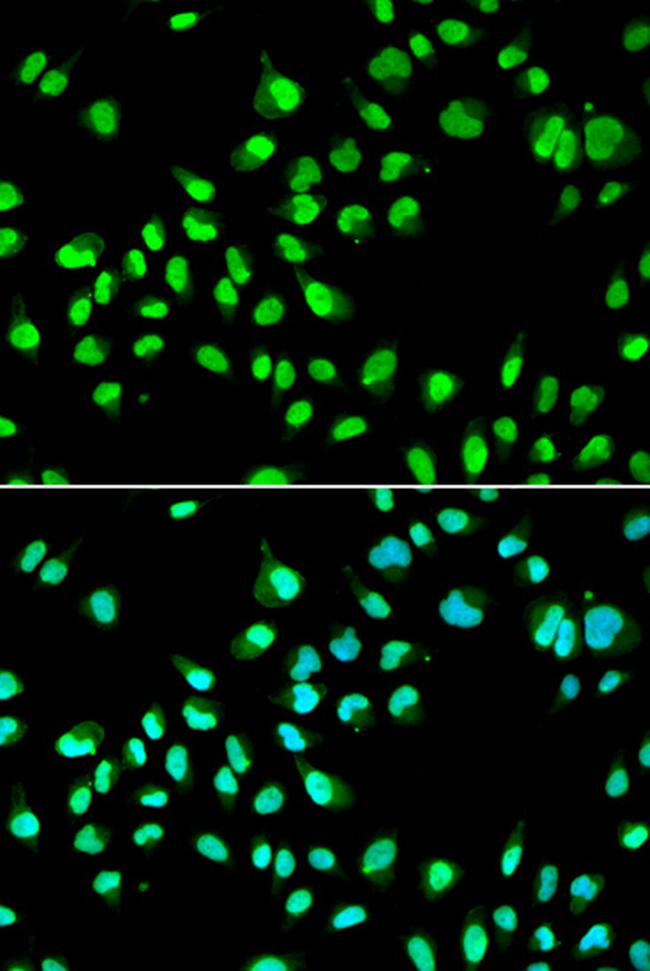 GTF2F2 Antibody in Immunocytochemistry (ICC/IF)