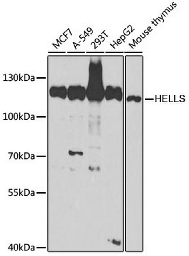 HELLS Antibody in Western Blot (WB)