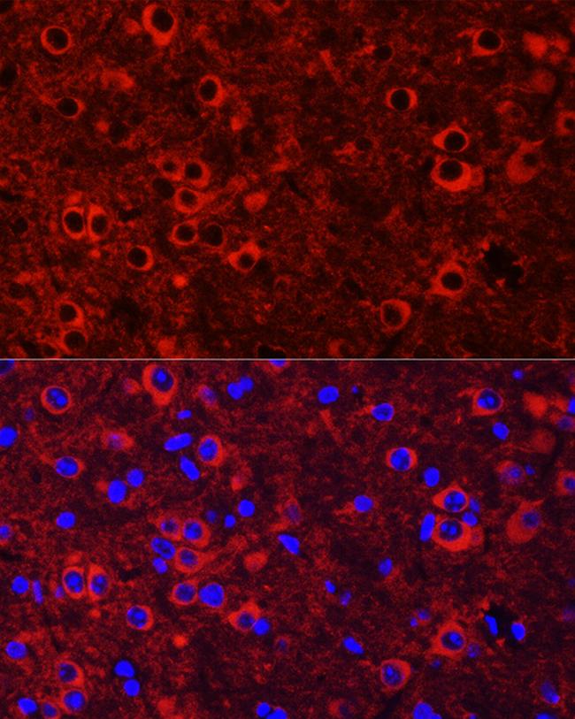 TrkC Antibody in Immunocytochemistry (ICC/IF)