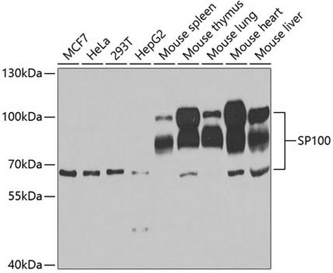 SP100 Antibody in Western Blot (WB)