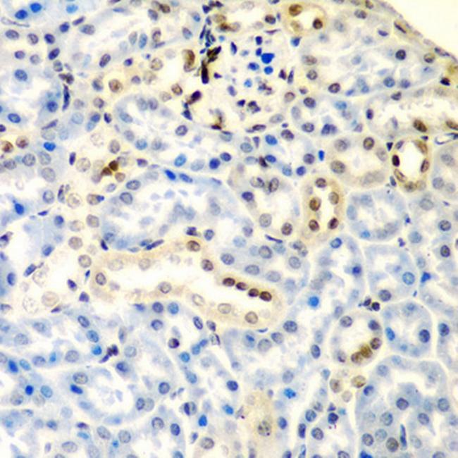 DCTD Antibody in Immunohistochemistry (Paraffin) (IHC (P))