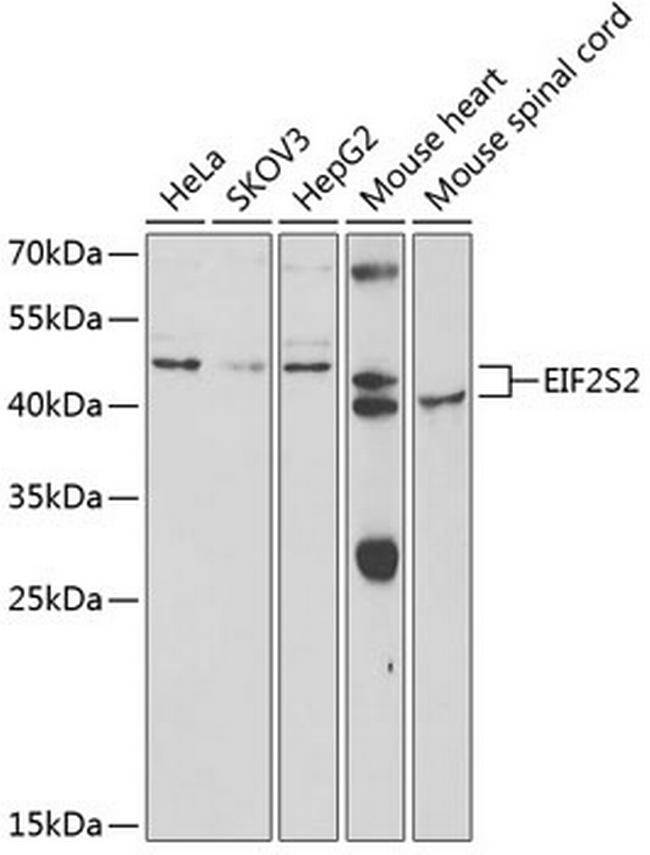 eIF2 beta Antibody in Western Blot (WB)