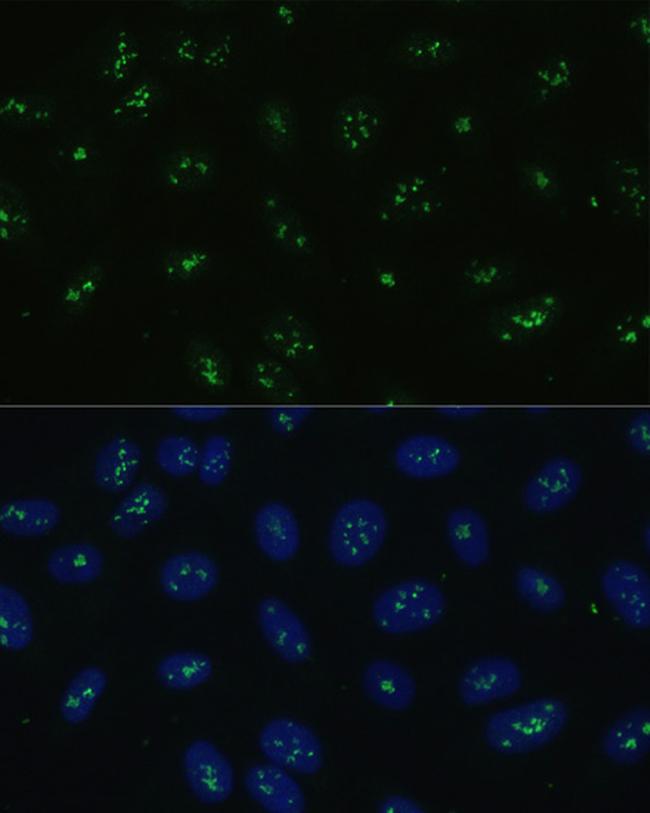 NOLC1 Antibody in Immunocytochemistry (ICC/IF)