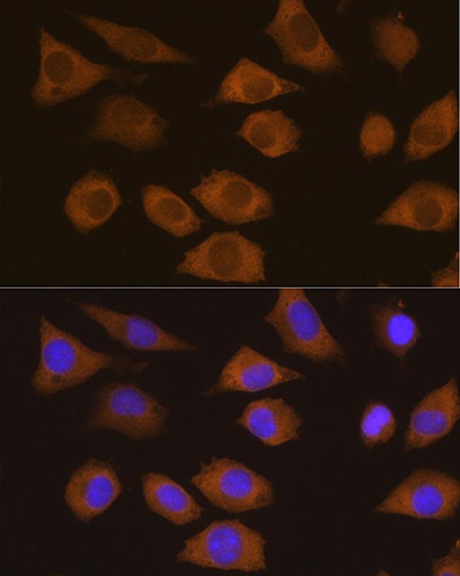 CSDE1 Antibody in Immunocytochemistry (ICC/IF)