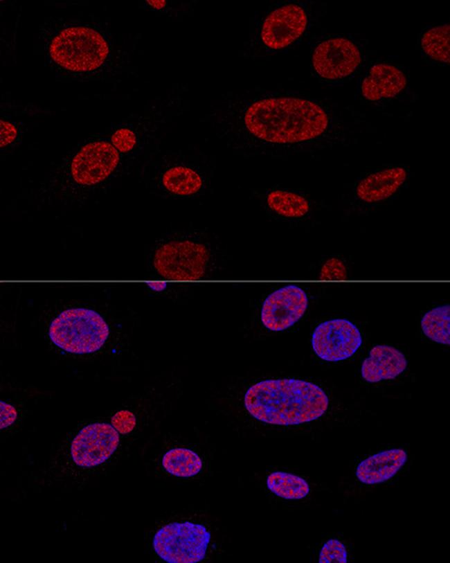 ALY Antibody in Immunocytochemistry (ICC/IF)