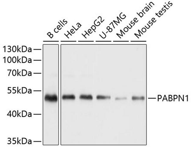 PABPN1 Antibody in Western Blot (WB)