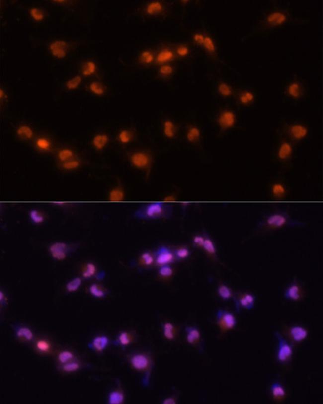 PRP8 Antibody in Immunocytochemistry (ICC/IF)