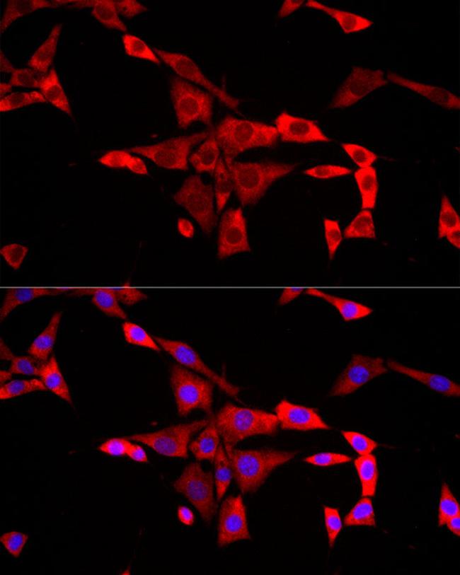 FMRP Antibody in Immunocytochemistry (ICC/IF)