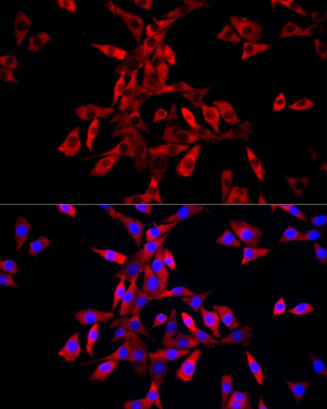 IGF2BP3 Antibody in Immunocytochemistry (ICC/IF)