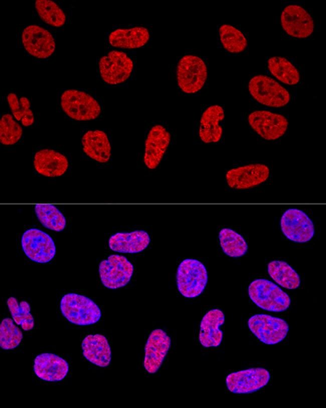 SAM68 Antibody in Immunocytochemistry (ICC/IF)