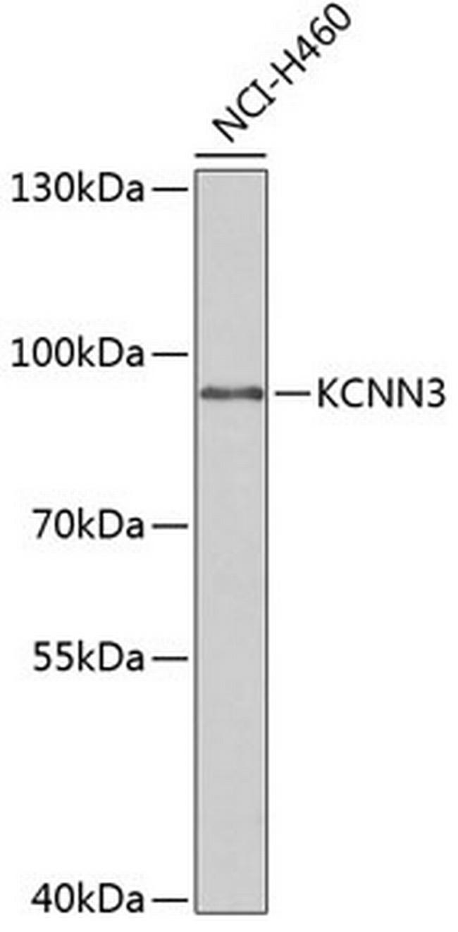 KCNN3 Antibody in Western Blot (WB)