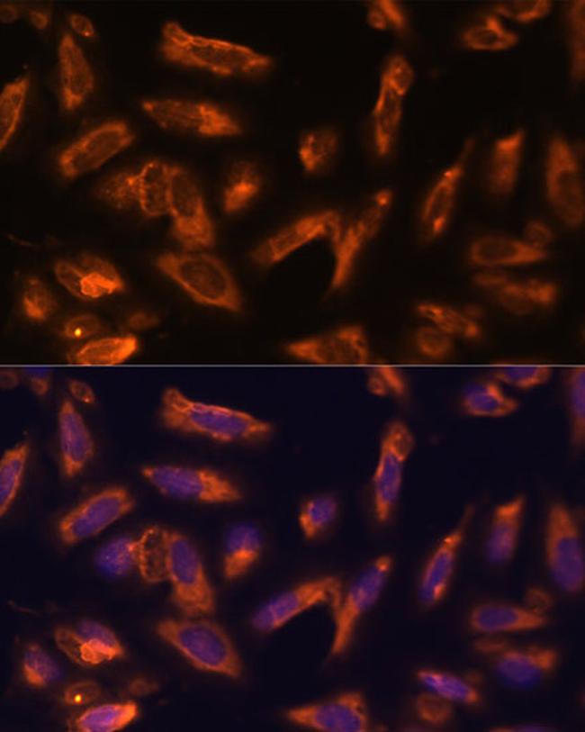 GM-CSF Antibody in Immunocytochemistry (ICC/IF)