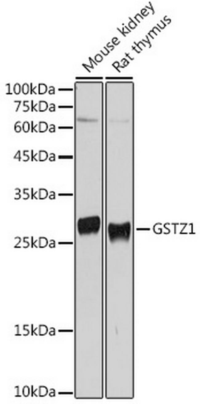 GSTZ1 Antibody in Western Blot (WB)