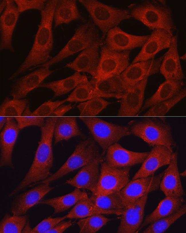 Osteocalcin Antibody in Immunocytochemistry (ICC/IF)