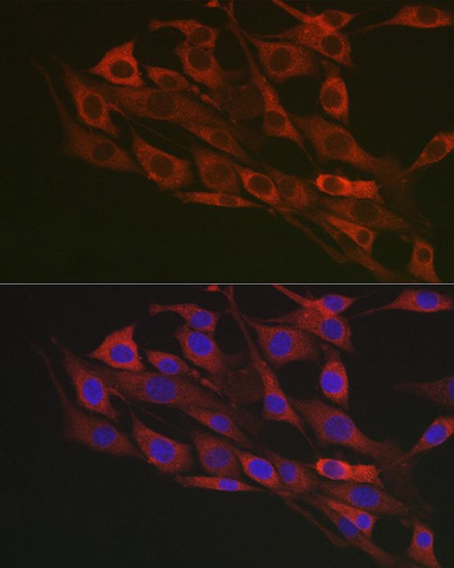 Flotillin 1 Antibody in Immunocytochemistry (ICC/IF)