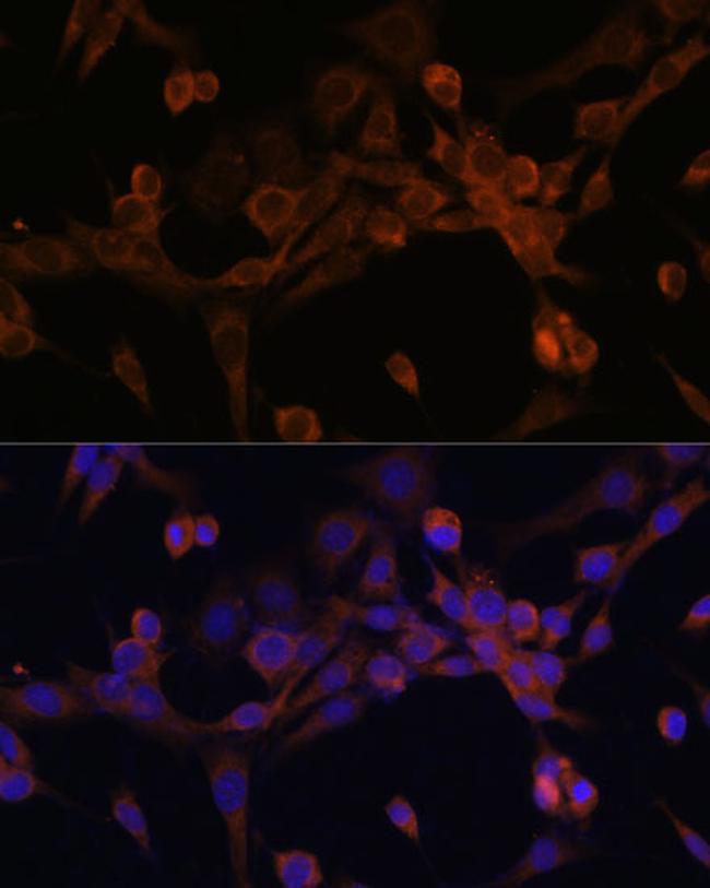 eIF2b beta Antibody in Immunocytochemistry (ICC/IF)