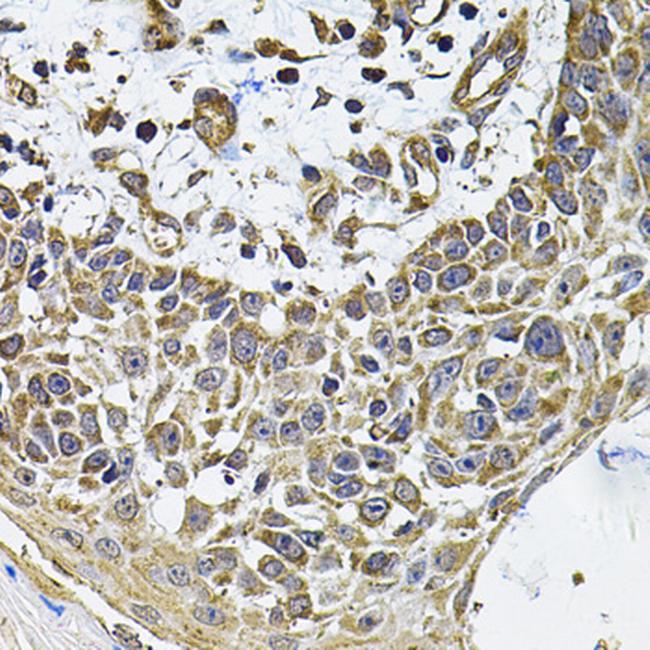 CD275 (B7-H2) Antibody in Immunohistochemistry (Paraffin) (IHC (P))