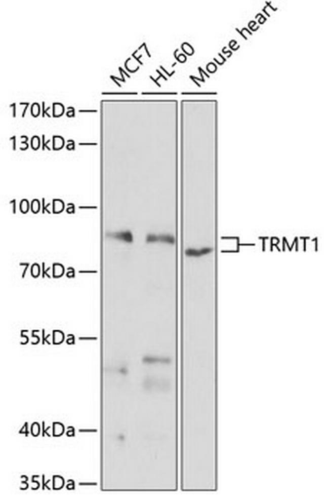 TRMT1 Antibody in Western Blot (WB)