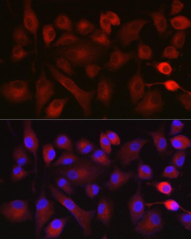 NOX5 Antibody in Immunocytochemistry (ICC/IF)