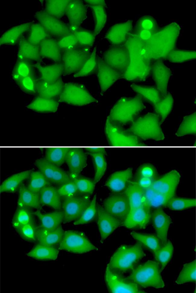 STS1 Antibody in Immunocytochemistry (ICC/IF)