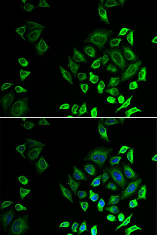 PLA2G2D Antibody in Immunocytochemistry (ICC/IF)