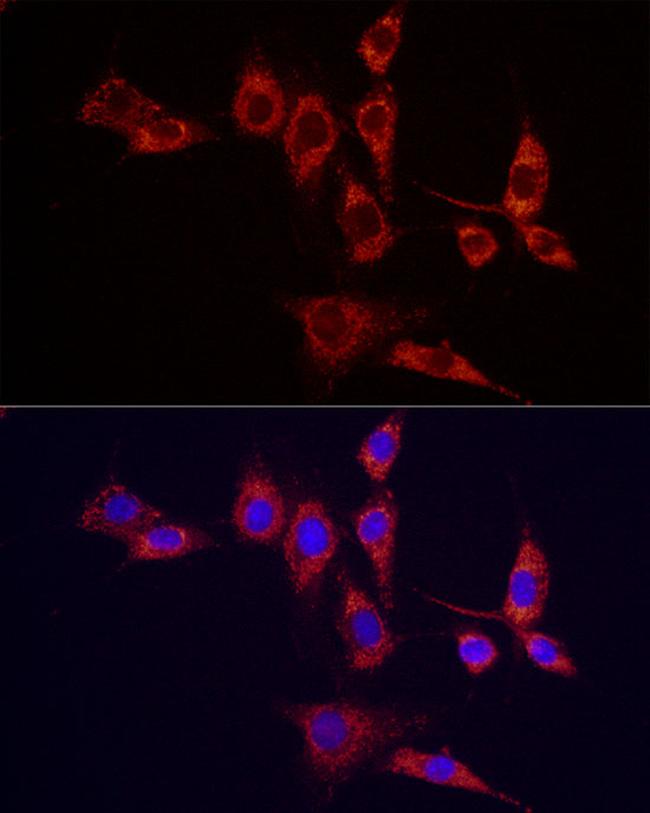 IDH2 Antibody in Immunocytochemistry (ICC/IF)