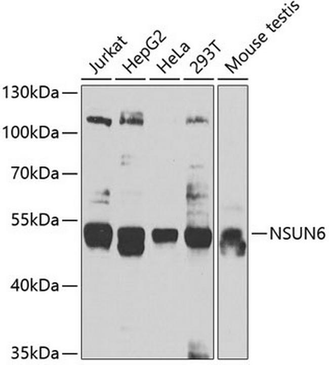 NSUN6 Antibody in Western Blot (WB)