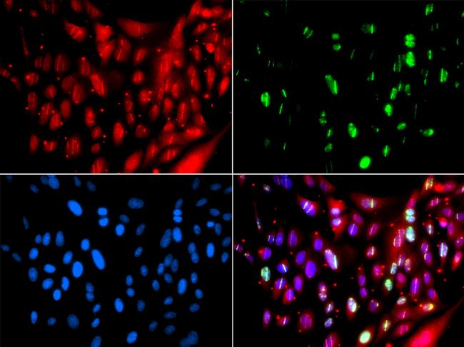 RAP80 Antibody in Immunocytochemistry (ICC/IF)