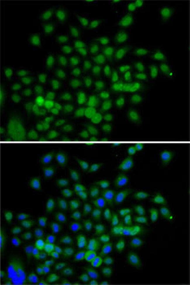 BCAS3 Antibody in Immunocytochemistry (ICC/IF)