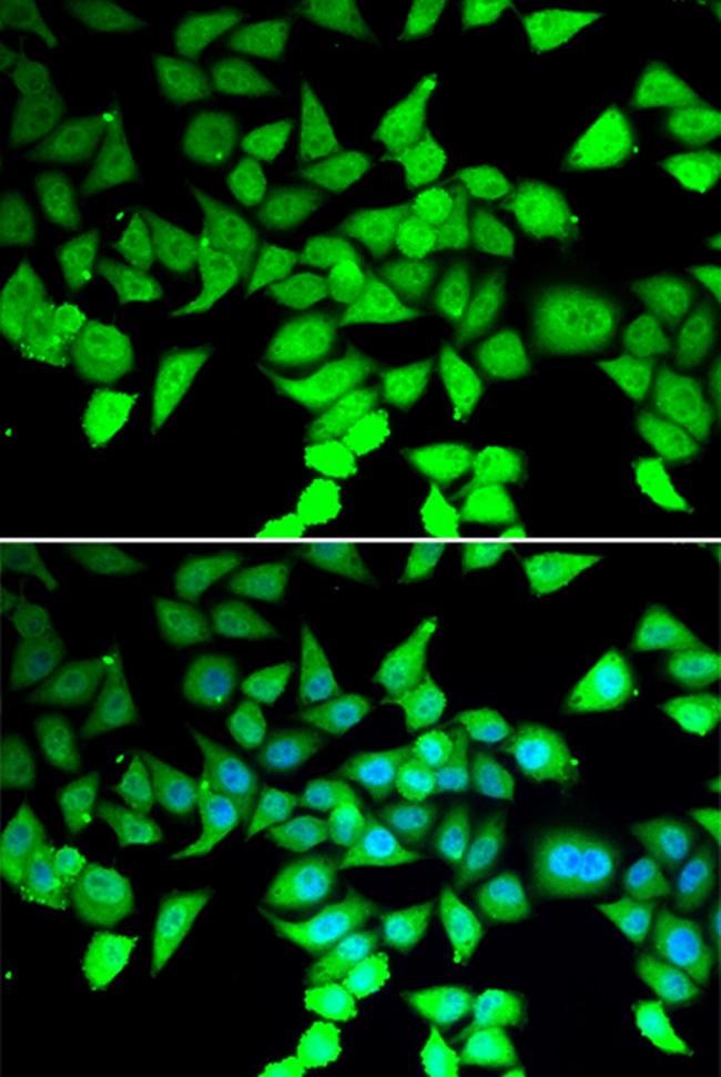 HDAC7 Antibody in Immunocytochemistry (ICC/IF)