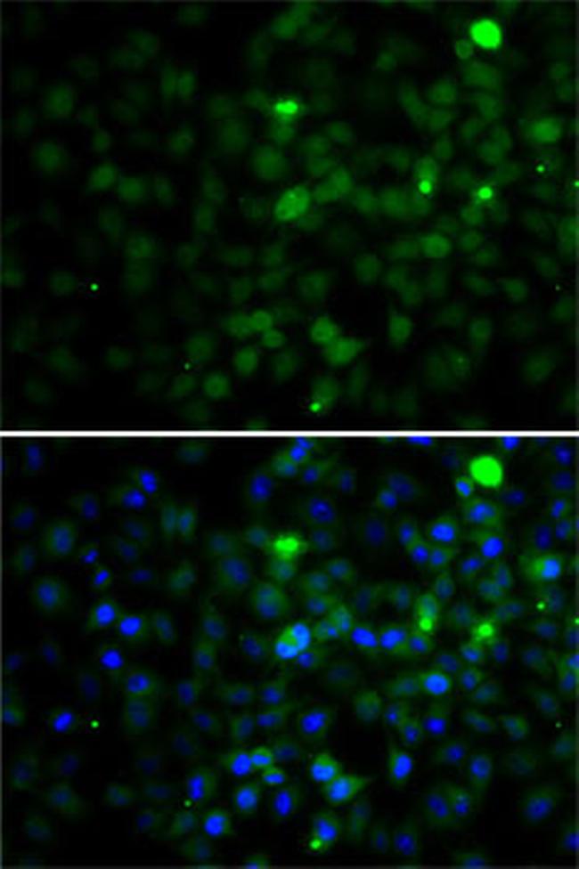 SMYD4 Antibody in Immunocytochemistry (ICC/IF)