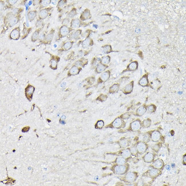 EEF1A2 Antibody in Immunohistochemistry (Paraffin) (IHC (P))