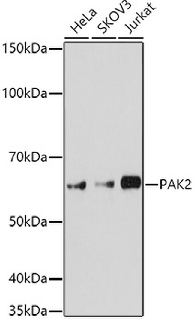 PAK2 Antibody in Western Blot (WB)