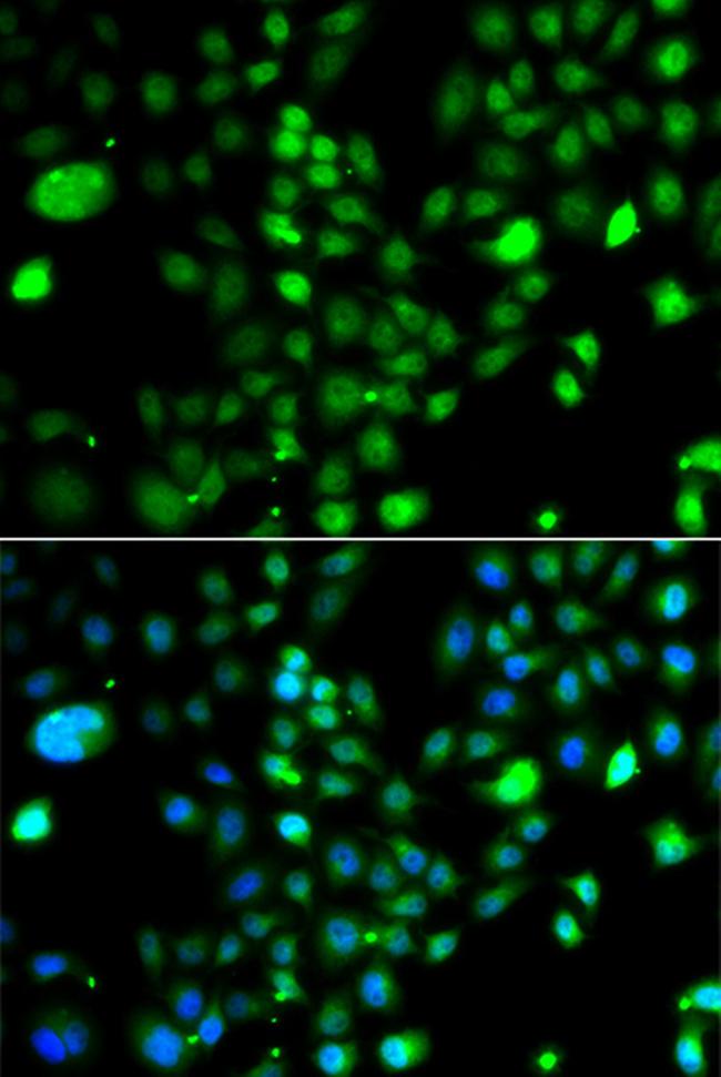 PRDM5 Antibody in Immunocytochemistry (ICC/IF)