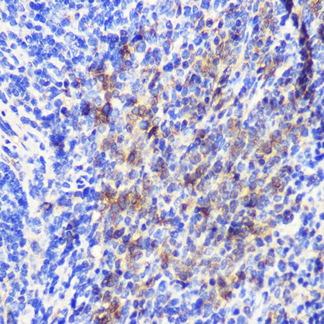 ATG10 Antibody in Immunohistochemistry (Paraffin) (IHC (P))