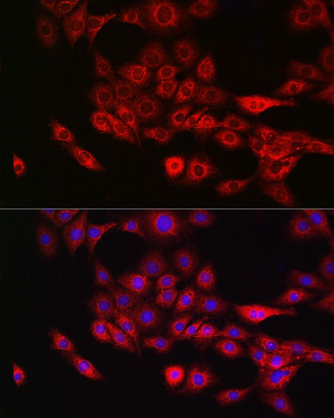 Annexin A11 Antibody in Immunocytochemistry (ICC/IF)