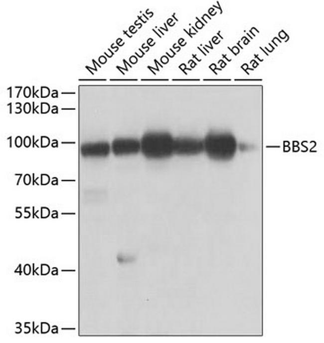 BBS2 Antibody in Western Blot (WB)