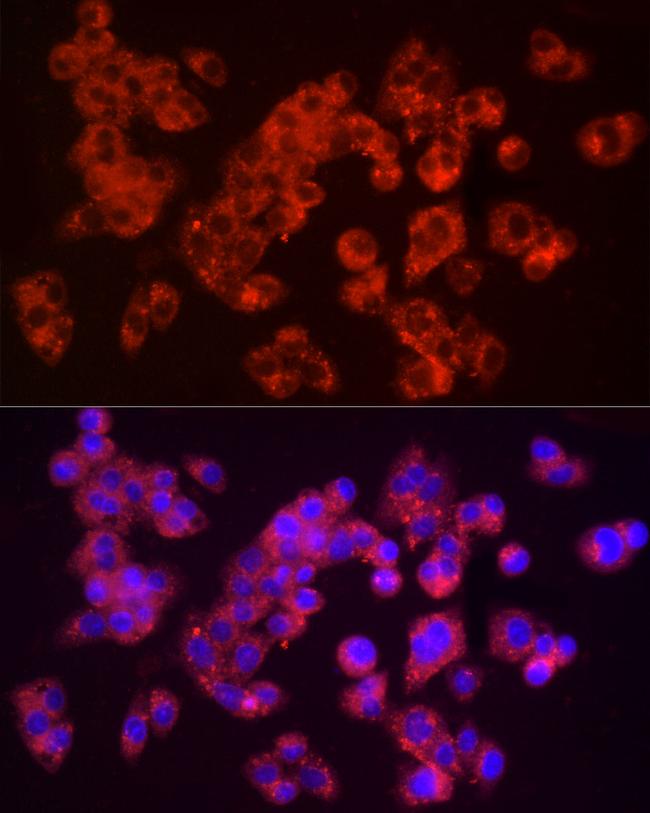 Furin Antibody in Immunocytochemistry (ICC/IF)